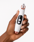 Blackhead Remover - photo4 scale hand